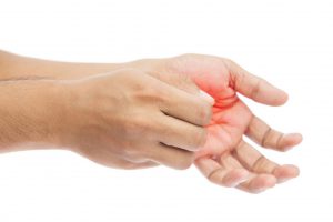 La dyshidrose palmo-plantaire, ou eczéma, conduit à se gratter les paumes des mains.