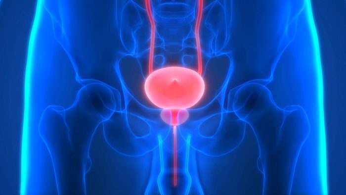 Un risque de cancer de la prostate multiplié par 5 en cas de MICI